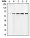 Apoptosis Inducing Factor Mitochondria Associated 1 antibody, orb214863, Biorbyt, Western Blot image 