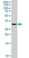 Aldo-Keto Reductase Family 1 Member E2 antibody, H00083592-B01P, Novus Biologicals, Western Blot image 