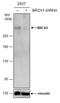 BRCA1 DNA Repair Associated antibody, NBP1-41186, Novus Biologicals, Western Blot image 