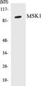 Ribosomal Protein S6 Kinase A5 antibody, EKC1386, Boster Biological Technology, Western Blot image 