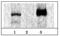 SWI/SNF Related, Matrix Associated, Actin Dependent Regulator Of Chromatin, Subfamily A, Member 4 antibody, GTX00727, GeneTex, Immunoprecipitation image 