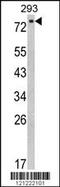 EPS8 Like 3 antibody, MBS9200799, MyBioSource, Western Blot image 