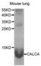 Calcitonin Related Polypeptide Alpha antibody, abx004242, Abbexa, Western Blot image 