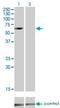 Interleukin 1 Receptor Associated Kinase 3 antibody, H00011213-M02, Novus Biologicals, Western Blot image 
