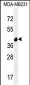 leucine-rich repeat-containing protein 72 antibody, PA5-48306, Invitrogen Antibodies, Western Blot image 