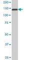 Trafficking Protein Particle Complex 10 antibody, H00007109-M02, Novus Biologicals, Western Blot image 