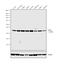 Cyclin Dependent Kinase 2 antibody, MA5-17052, Invitrogen Antibodies, Western Blot image 