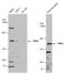 Formin 2 antibody, GTX131161, GeneTex, Western Blot image 