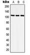 Cyclin-dependent kinase-like 5 antibody, GTX55218, GeneTex, Western Blot image 