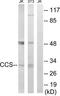 Copper Chaperone For Superoxide Dismutase antibody, TA314999, Origene, Western Blot image 