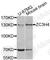 Zinc Finger CCCH-Type Containing 4 antibody, A5971, ABclonal Technology, Western Blot image 