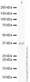 STIP1 Homology And U-Box Containing Protein 1 antibody, ab2917, Abcam, Western Blot image 