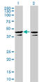 Casein Kinase 2 Alpha 1 antibody, LS-C196985, Lifespan Biosciences, Western Blot image 