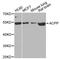 Acid Phosphatase, Prostate antibody, A1937, ABclonal Technology, Western Blot image 