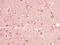 Cell Death Inducing DFFA Like Effector A antibody, CSB-PA005431LA01HU, Cusabio, Immunohistochemistry frozen image 