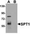 SPTLC1 antibody, LS-C144369, Lifespan Biosciences, Western Blot image 