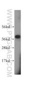 Secretory Carrier Membrane Protein 1 antibody, 15327-1-AP, Proteintech Group, Western Blot image 