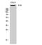 ATR Serine/Threonine Kinase antibody, A00262-1, Boster Biological Technology, Western Blot image 