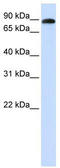 ADAM Metallopeptidase Domain 19 antibody, TA338634, Origene, Western Blot image 