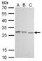 High Mobility Group Box 1 antibody, GTX628835, GeneTex, Western Blot image 