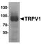 Transient Receptor Potential Cation Channel Subfamily V Member 1 antibody, A00128, Boster Biological Technology, Western Blot image 