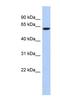 CaM Kinase Like Vesicle Associated antibody, NBP1-56677, Novus Biologicals, Western Blot image 