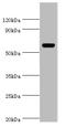 GC Vitamin D Binding Protein antibody, A57866-100, Epigentek, Western Blot image 