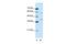 Heterogeneous Nuclear Ribonucleoprotein A3 antibody, GTX47186, GeneTex, Western Blot image 