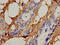 Laryngeal cancer kinase 2 antibody, CSB-PA891800LA01HU, Cusabio, Immunohistochemistry frozen image 