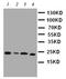 Phosphatidylethanolamine Binding Protein 1 antibody, LS-C312864, Lifespan Biosciences, Western Blot image 