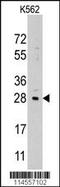 Lin-28 Homolog B antibody, MBS9215062, MyBioSource, Western Blot image 