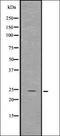 Epidermal Growth Factor Receptor Pathway Substrate 15 Like 1 antibody, orb336741, Biorbyt, Western Blot image 