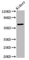 G Protein-Coupled Receptor Kinase 5 antibody, CSB-PA009926LA01HU, Cusabio, Western Blot image 