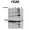 Frizzled Related Protein antibody, NBP1-79551, Novus Biologicals, Western Blot image 