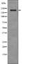 Erb-B2 Receptor Tyrosine Kinase 4 antibody, PA5-64799, Invitrogen Antibodies, Western Blot image 