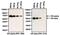 Estrogen Receptor 1 antibody, PA1-309, Invitrogen Antibodies, Western Blot image 