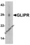 GLI Pathogenesis Related 1 antibody, 7623, ProSci, Western Blot image 