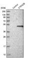 STE20 Related Adaptor Beta antibody, NBP1-90184, Novus Biologicals, Western Blot image 