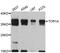 Torsin Family 1 Member A antibody, STJ110927, St John