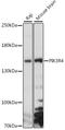 Phosphoinositide-3-Kinase Regulatory Subunit 4 antibody, A15828, ABclonal Technology, Western Blot image 