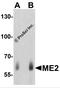 Malic Enzyme 2 antibody, 7723, ProSci, Western Blot image 