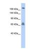 VPS8 Subunit Of CORVET Complex antibody, NBP1-55274, Novus Biologicals, Western Blot image 