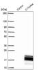 Chromosome 17 Open Reading Frame 64 antibody, PA5-60703, Invitrogen Antibodies, Western Blot image 