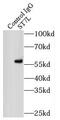 Suppression Of Tumorigenicity 7 Like antibody, FNab08274, FineTest, Immunoprecipitation image 