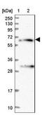 Rho Related BTB Domain Containing 1 antibody, NBP1-81485, Novus Biologicals, Western Blot image 
