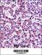 Nicotinamide N-Methyltransferase antibody, 57-263, ProSci, Immunohistochemistry frozen image 