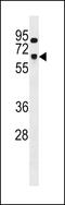 Small Nuclear Ribonucleoprotein U1 Subunit 70 antibody, 58-902, ProSci, Western Blot image 