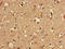 Sortilin Related VPS10 Domain Containing Receptor 2 antibody, orb51842, Biorbyt, Immunohistochemistry paraffin image 
