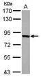 Threonyl-TRNA Synthetase antibody, GTX116359, GeneTex, Western Blot image 