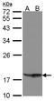 Phospholipase A And Acyltransferase 4 antibody, LS-C185908, Lifespan Biosciences, Western Blot image 